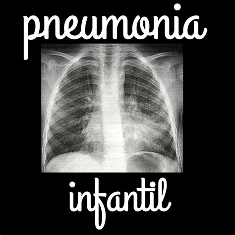 sintomas pneumonia infantil